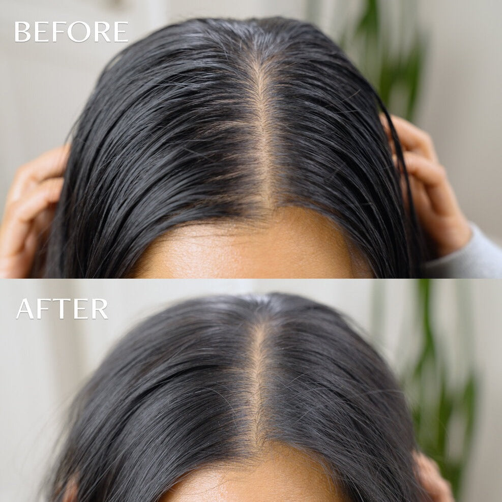 Day After Brush Dry Shampoo Bundle - 2 Patented Applicators