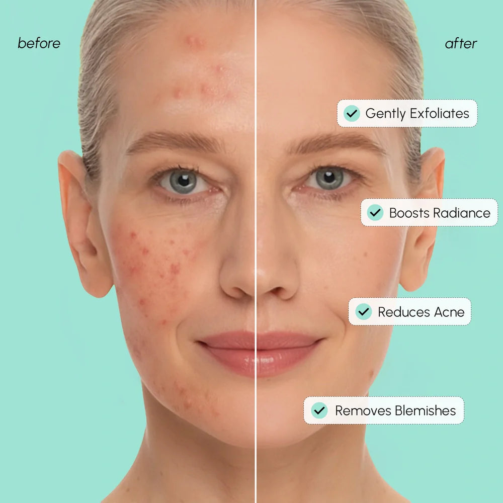 Marée Azelaic Acid Soothing Pads - Reduce Redness & Blemishes